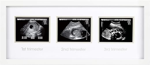 Trimester Progression Sonogram Picture Frame